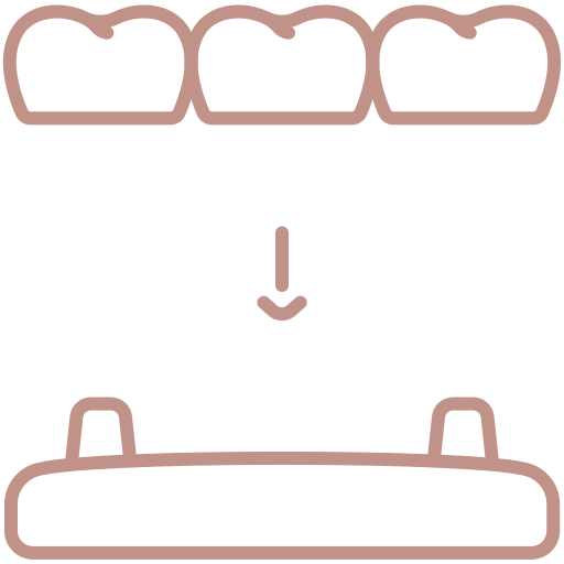 Réhabilitation complète de la bouche