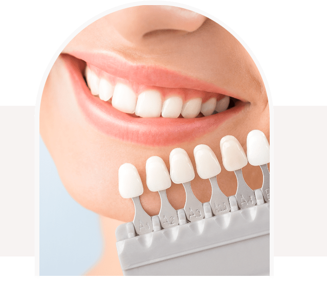 teeth whitening